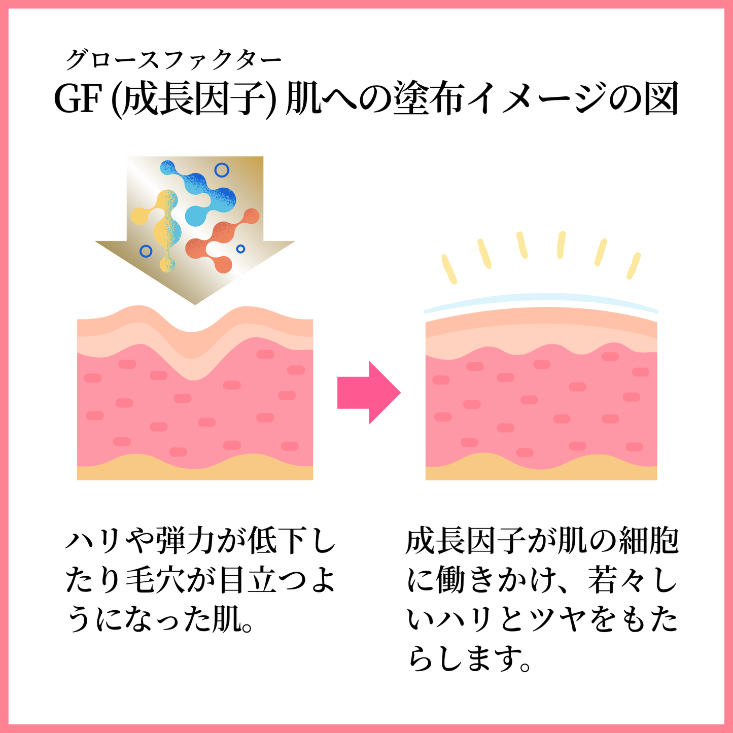 ZEROONE モイストクリーム